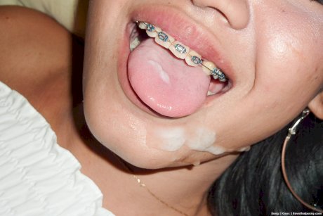 Thai girl Song takes a cumshot in her braces filled mouth after POV fucking