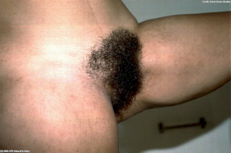 ATK Hairy Angela